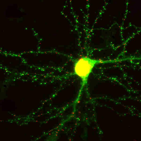 How memories look like - Living neuron